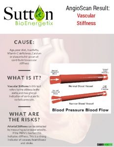 thumbnail of Vascular Stiffness